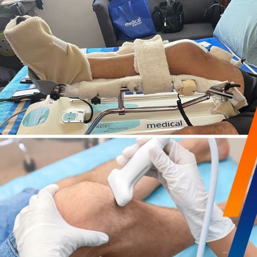 Movilizador Pasivo Rodilla vs Terapia tradicional