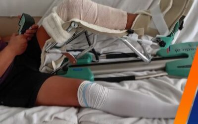 ¿Por qué el Movilizador Pasivo de Rodilla será esencial en fisioterapia 2025?