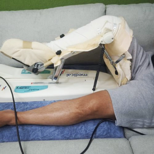 la diferencia que hace un movilizador pasivo de rodilla en la rehabilitación paciente real