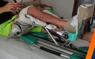 Terapia después de cirugía de rodilla: guía de recuperación